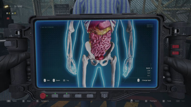 730px-QuarantineZoneTLC-FattyHepatosis.jpeg